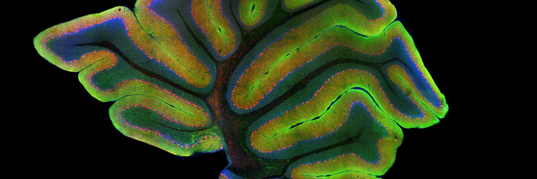 Laser scanning confocal image of a mouse cerebellum. Credit: Gabriel Luna