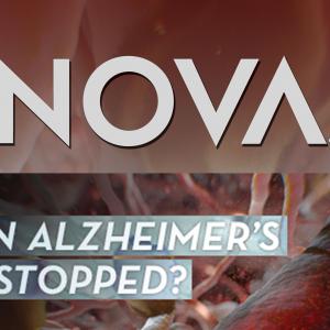 Can Alzheimer's Be Stopped?