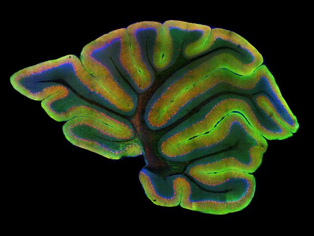 Cellular Neurobiology and Pathobiology