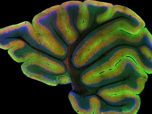 Laser scanning confocal image of a mouse cerebellum. Credit: Gabriel Luna