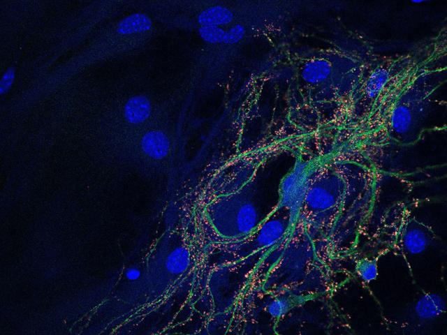 Stem Cells and Neurodevelopment