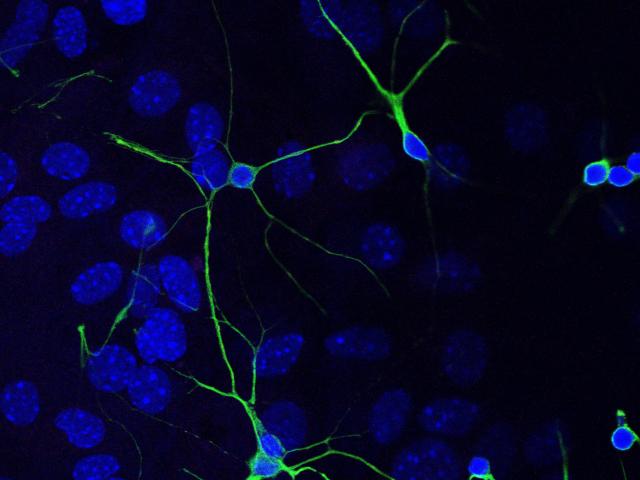 P1 pups grown on coverslips. Credit: Mukund Hari