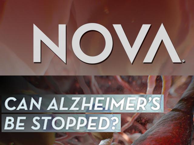 Can Alzheimer's Be Stopped?